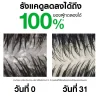 VICHY Dercos Anti-Dandruff Shampoo Normal To Oily Hair (200 ml)
